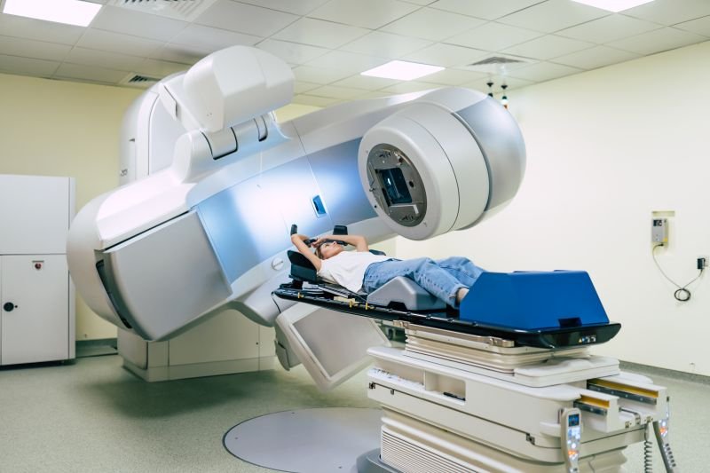 radioterapia w polsce raport