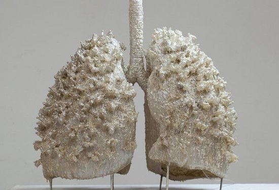 Jak zadbać o zdrowe płuca? Czynniki ryzyka i screening w raku płuca