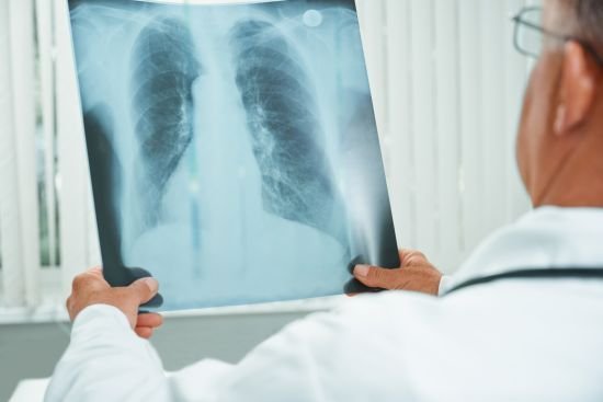 Leczenie personalizowane raka płuca