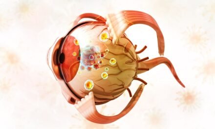 Czerniak gałki ocznej (czerniak oka) – objawy i leczenie
