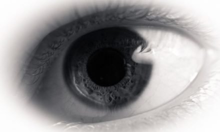 Czerniak gałki ocznej (czerniak oka) – objawy i leczenie