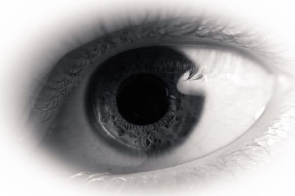 Czerniak gałki ocznej (czerniak oka) – objawy i leczenie