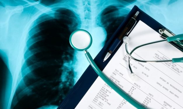 Diagnostyka raka płuc – wczesne wykrywanie