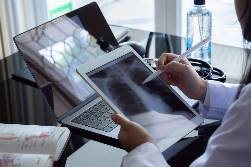 Biuro Interwencji Onkologicznej – porady onkologów online