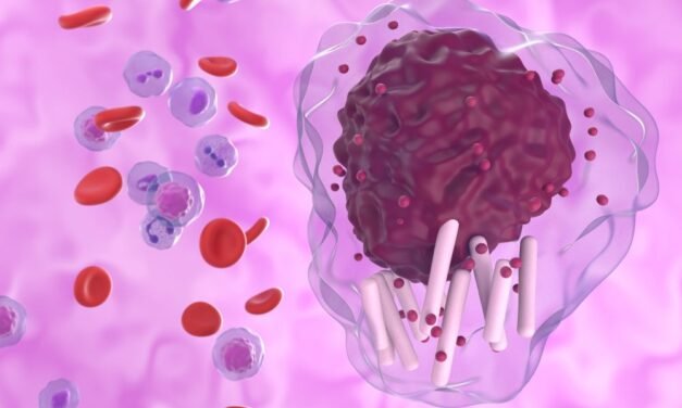 Przewlekła białaczka limfocytowa (PBL) – objawy i leczenie