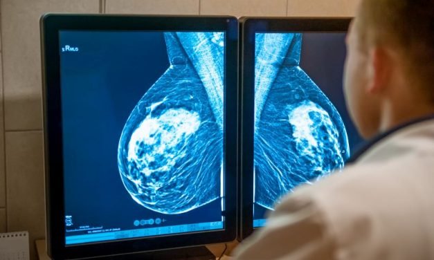 Nowoczesne leczenie raka piersi – poradnik