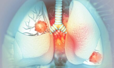 Niedrobnokomórkowy rak płuca – rodzaje, leczenie i rokowania