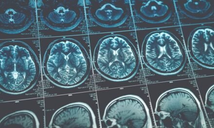 Guz mózgu – objawy i diagnostyka nowotworu