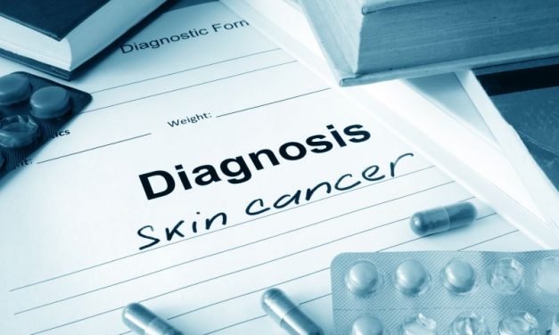 Rak kolczystokomórkowy skóry – objawy i leczenie