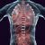 Wizualizacje 3D guzów nowotworowych – technologia zmieniająca oblicze onkologii