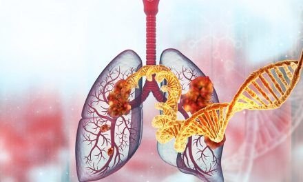 Wielkie zmiany w raku płuca? Relacja z sesji Forum Raka Płuca