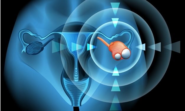 Rak jajnika – jak wygląda i jak wpływa na organizm? Wizualizacja 3D