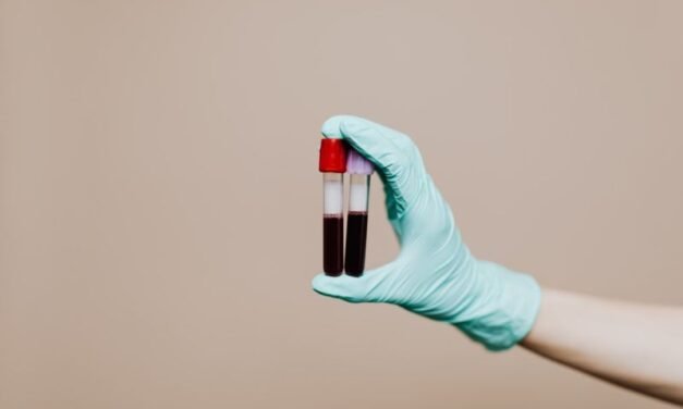 Morfologia krwi – o czym mówi to badanie krwi?