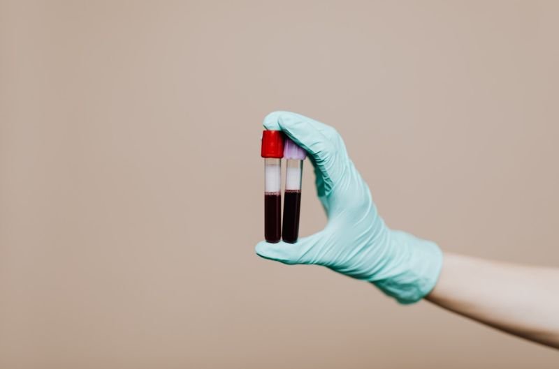 Morfologia krwi – o czym mówi to badanie krwi?