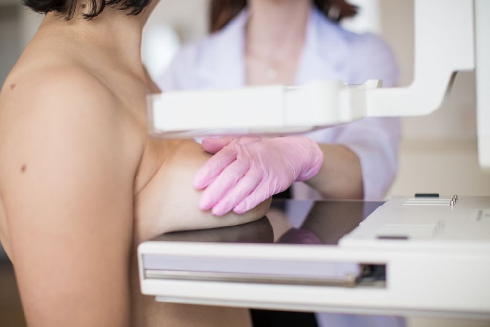 Czy mammografia jest bezpieczna / szkodliwa dla zdrowia?