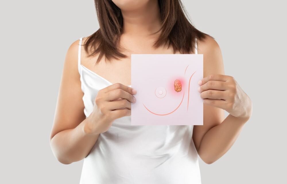 Jak zwiększyć świadomość profilaktyki raka piersi wśród Polek?