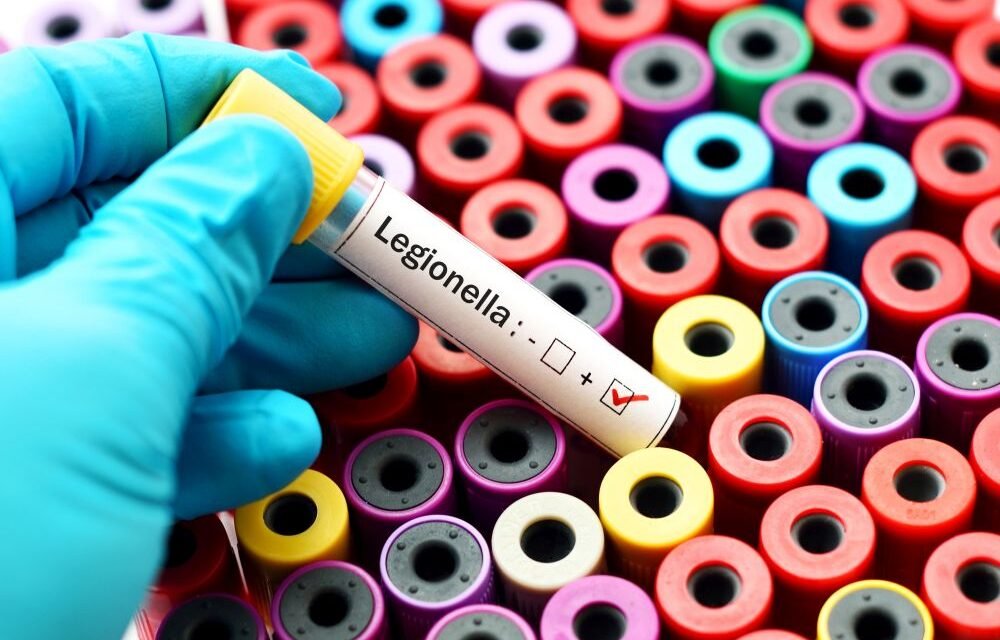 Legionella – bakteria odpowiedzialna za chorobę legionistów