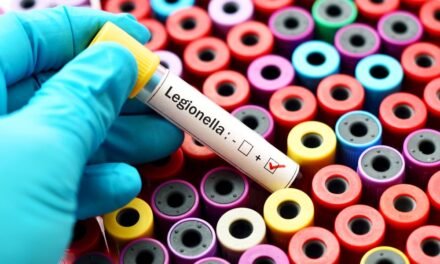 Legionella – bakteria odpowiedzialna za chorobę legionistów