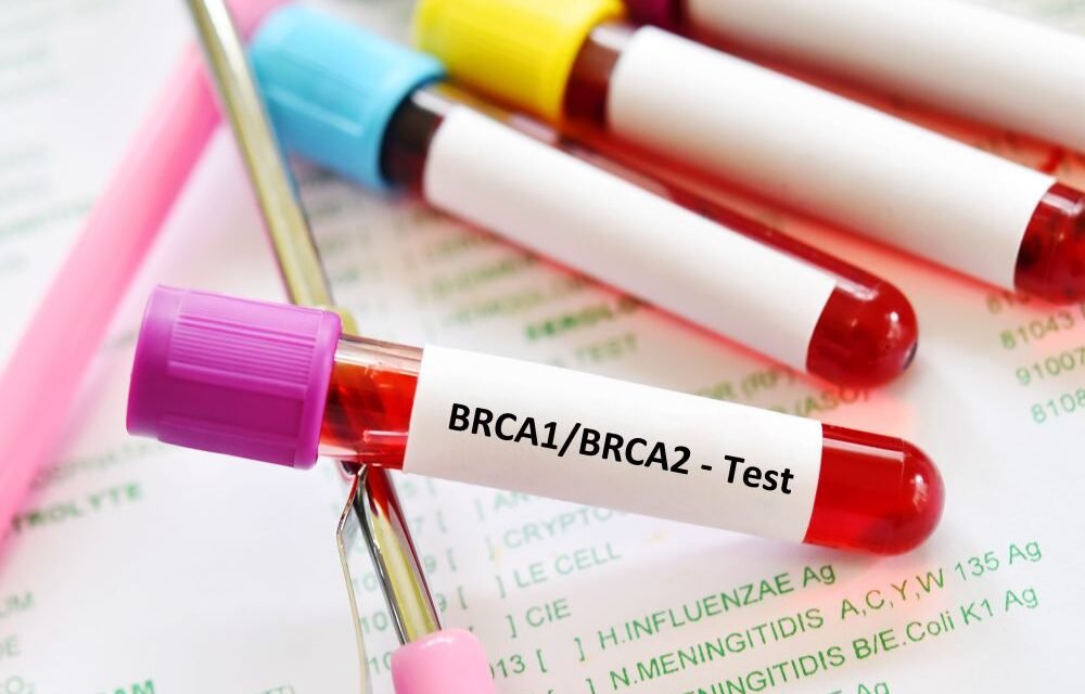 Diagnostyka molekularna raka piersi w kierunku mutacji w genach BRCA1/2