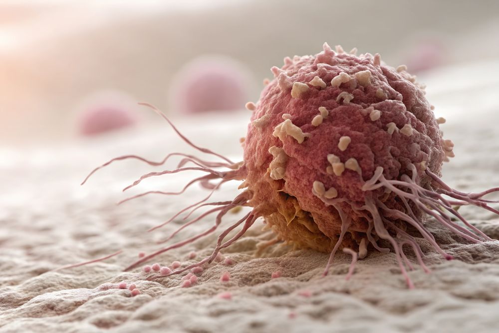 Guzy z zaburzeniami dMMR – immunoterapia zastąpi operację i chemioterapię?