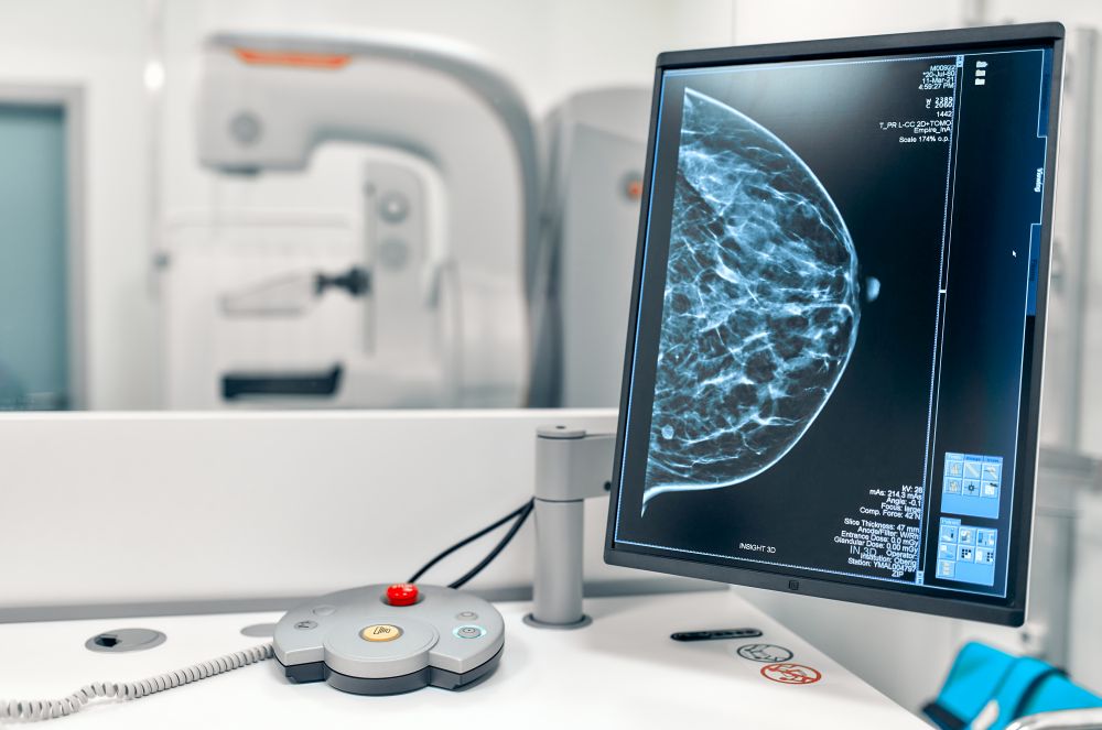 Szwajcaria zakazała mammografii? Eksperci obalają mity