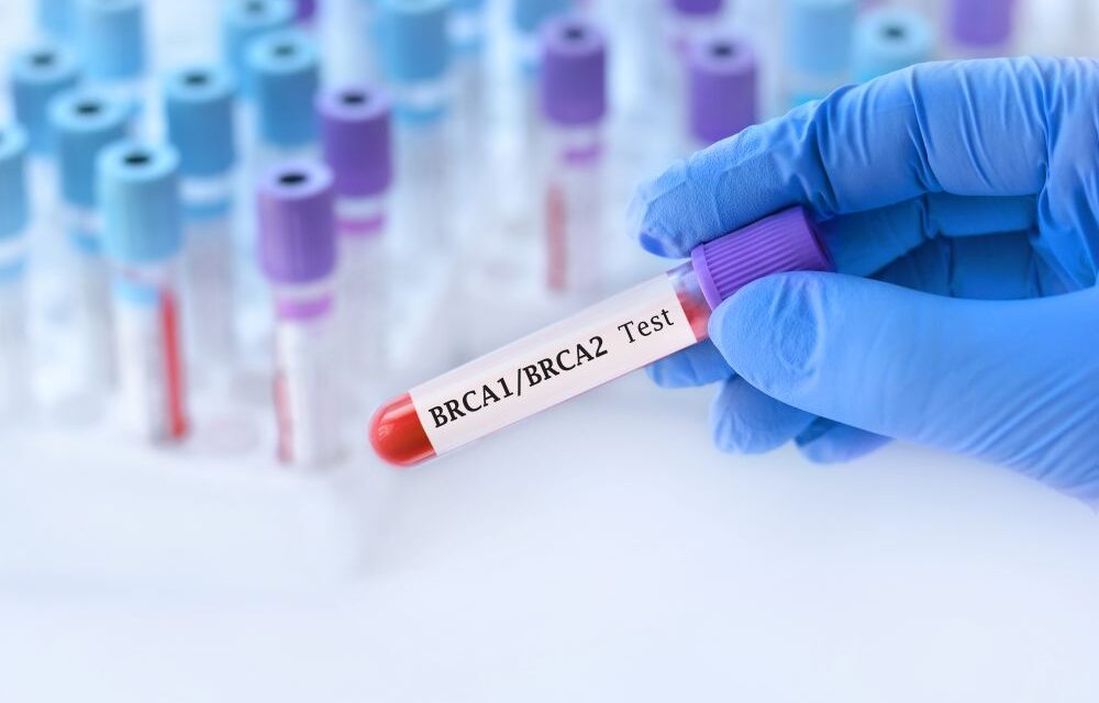 Zamieszanie z refundacją badań genetycznych w trybie ambulatoryjnym w nowotworach BRCA-zależnych