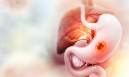 Nowotwory przewodu pokarmowego – aktualne wyzwania diagnostyczne i terapeutyczne